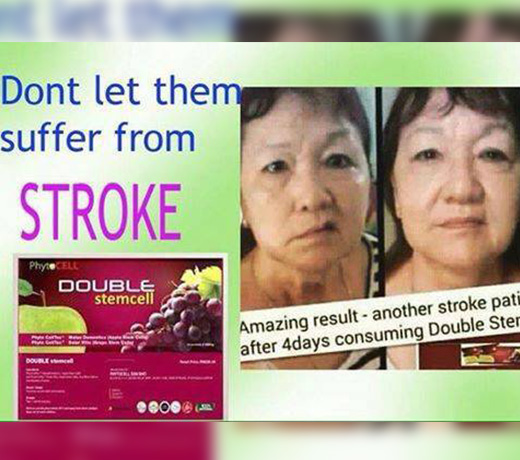 Stroke & Physical Mobility Restored